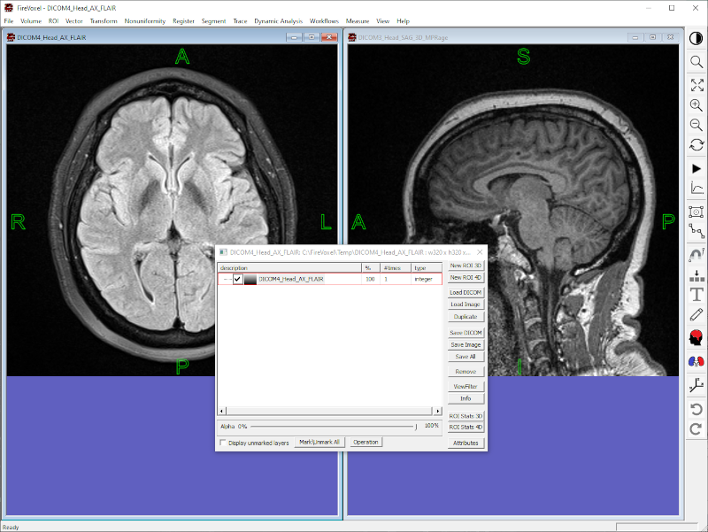 Images set up for coregistration with DICOM tags