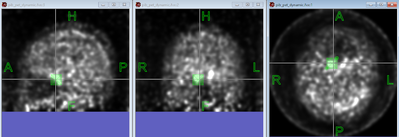 Vector ROI on PET image to initialize IDIF tool